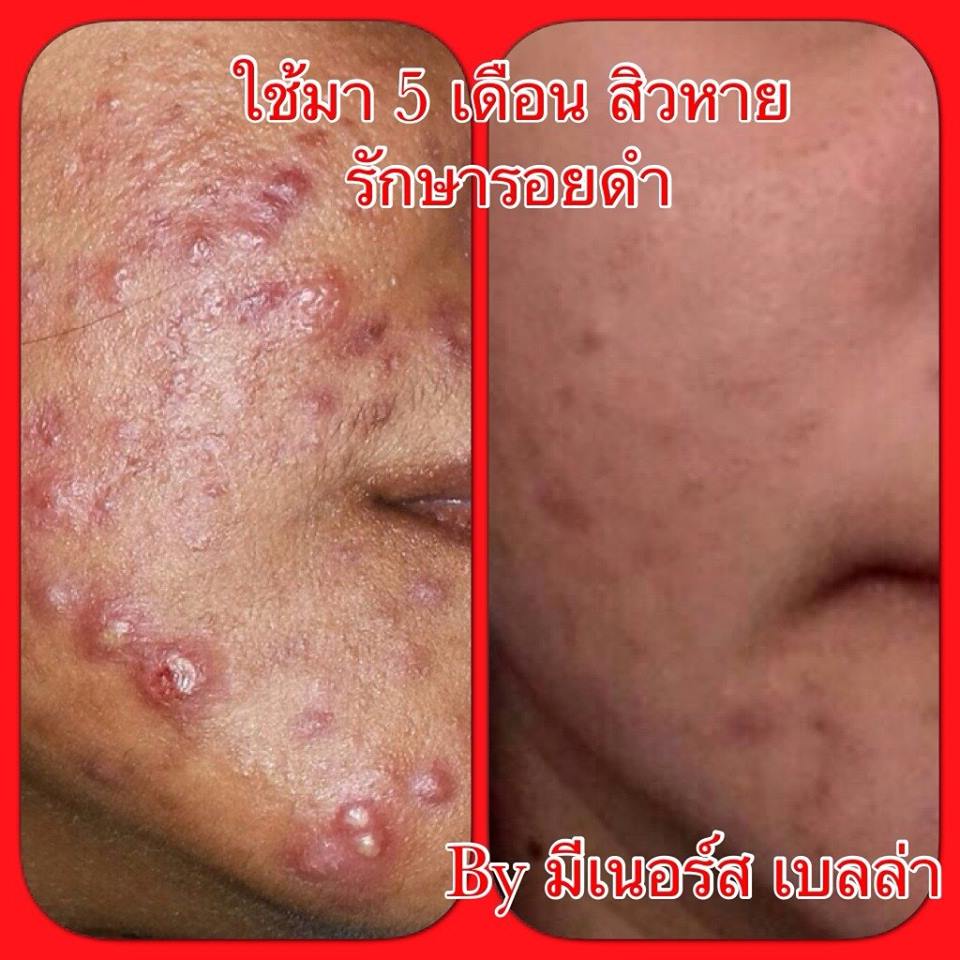ครีมดีมี อย.